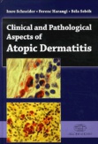 Clinical and Pathological Aspects of Atopic Dermatitis