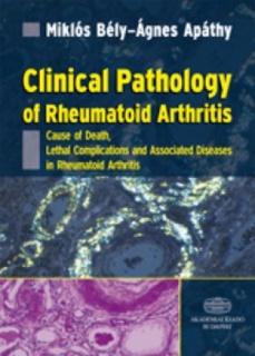 Clinical Pathology of Rheumatoid Arthritis